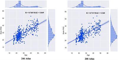 Accelerated Brain Aging in Patients With Obsessive-Compulsive Disorder